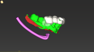 Bibbo, Donna, Mandible, 3D(11)