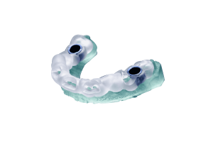 Teeth Supported Surgical Guide
