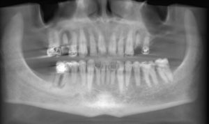 radiology report 
