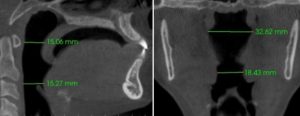 radiology report CBCT