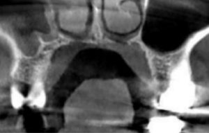 radiology report