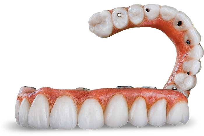 Final-Zirconia-full.-1 (1)