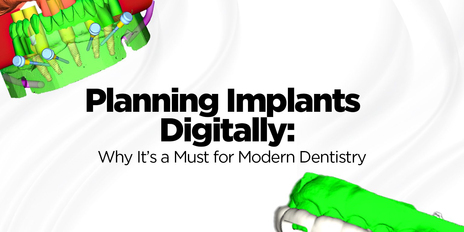 Planning Implants Digitally