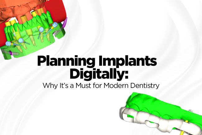 Planning Implants Digitally