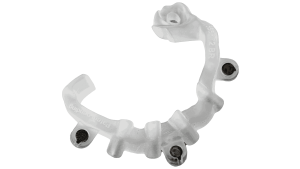 bone reduction guide 