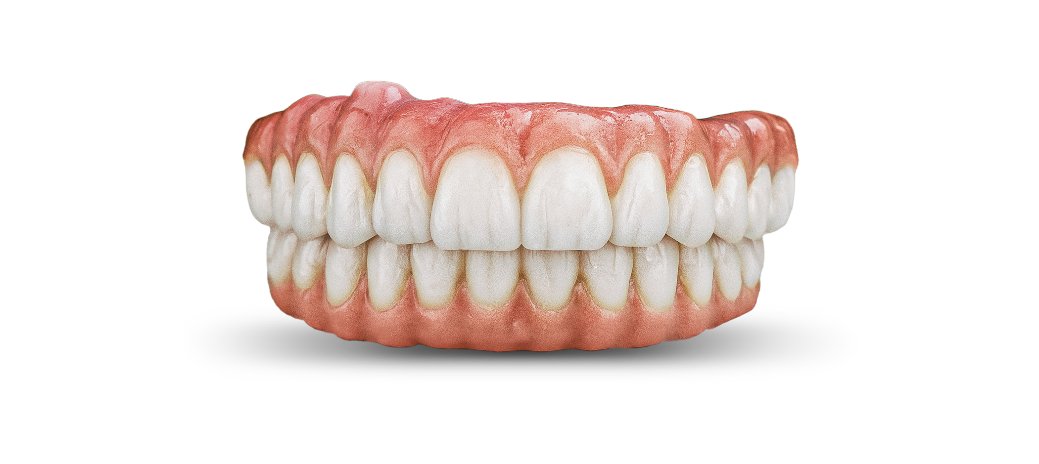 Final Zirconia full.